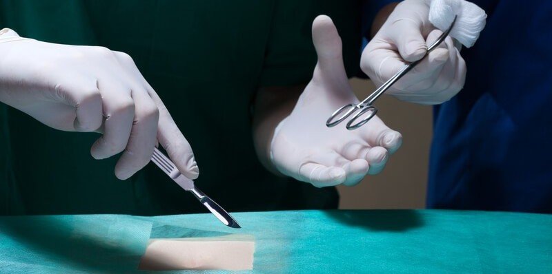 Cirurgias Reparadoras pelo plano de saúde: quem possui este direito?